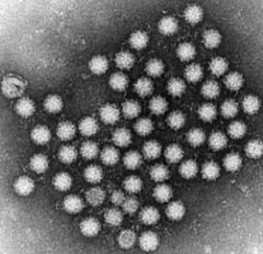 Norovirus